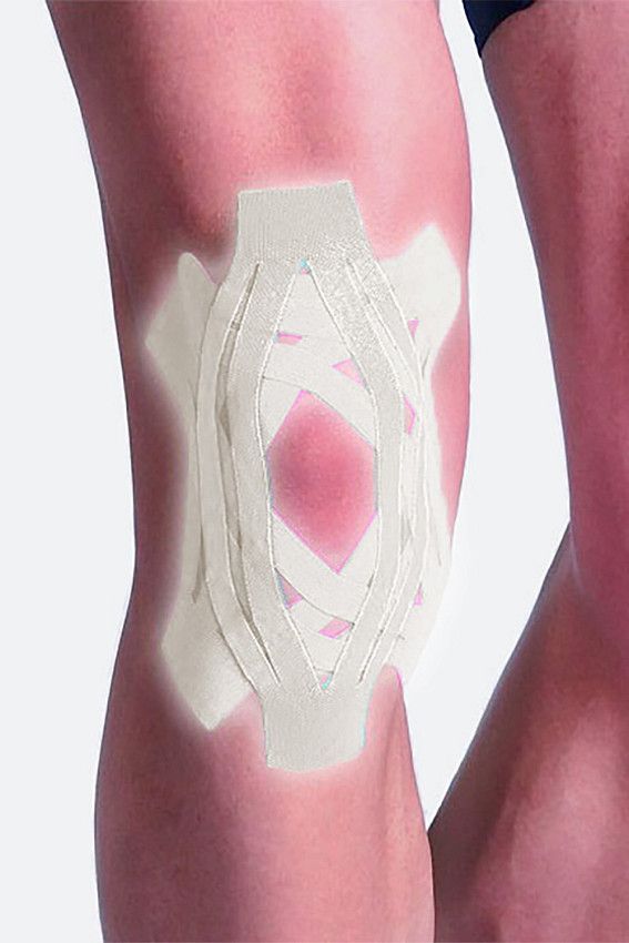 Тейп 18 см Lp support Бежевый